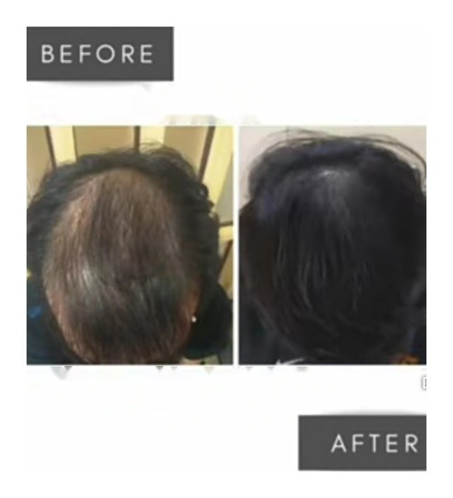 Hair treatment